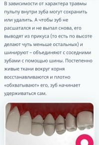 Да, но...