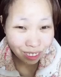 Потому что она операцию сделала. А раньше была такой.