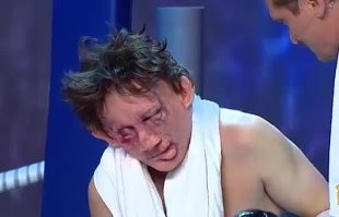 Человек, которого избил Тайсон, обычно выглядит как-то так.
