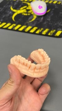 Сейчас протез можно напечатать на 3д принтере за пару часов. Капы, коронки, мосты, десна.. да все что угодно.