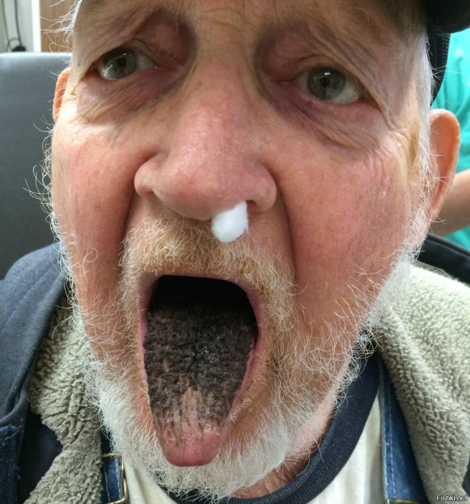 Учёные предупреждают: ковыряние в носу может привести к слабоумию