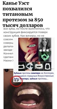 Канье Уэст похвалился титановым протезом за 850 тысяч долларов