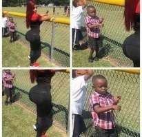 "Всё вытекло": во Владивостоке девушка хотела получить упругие ягодицы, а нашла кучу проблем на пятую точку