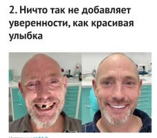 Хорошая попытка. Но закрашивать зуб на левой фотке нужно было поаккуратнее.