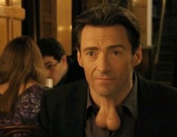 Пластические хирурги из Беларуси вырастили нос на руке