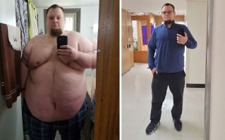 Уверен, что здесь (да и не только здесь) не обошлось без липосакции и удаления свисающей кожи. Может, и резекции желудка.