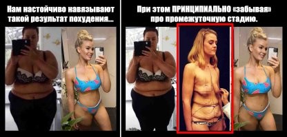 Вы серьёзно? Прям после сброса 100 кг вот такая идеальная фигура и ни единой складочки? А куда же девается растянутая кожа?