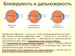 Глазное яблоко может иметь и эллиптическую форму.
