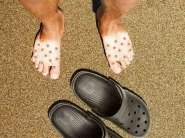 Сезон загара объявляется открытым