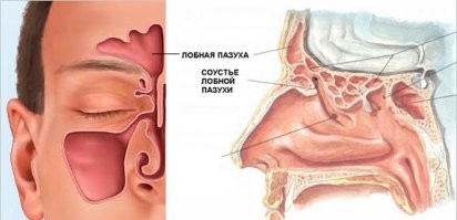 Было уже когда то здесь.
Фактически ему пробило кость пазухи, а не черепа (хотя, технически это тоже кость черепа, просто двойная), иначе ничего оттуда не повыпадало бы...
