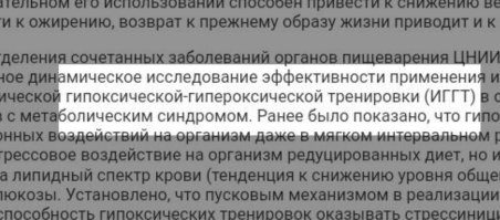 Там комплекс. По очереди, так сказать. То много, то мало.