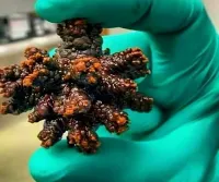 Особенно смущает статус ,,хорошее,, , присвоенный почечному камню...