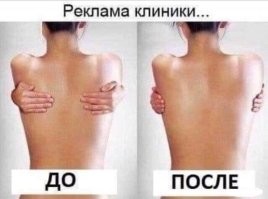 Остаётся только смеяться: всё о пластической хирургии