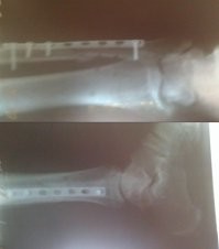 Зря смеётесь. 
Именно на саморезы. 

Вот, лично мои "фото":