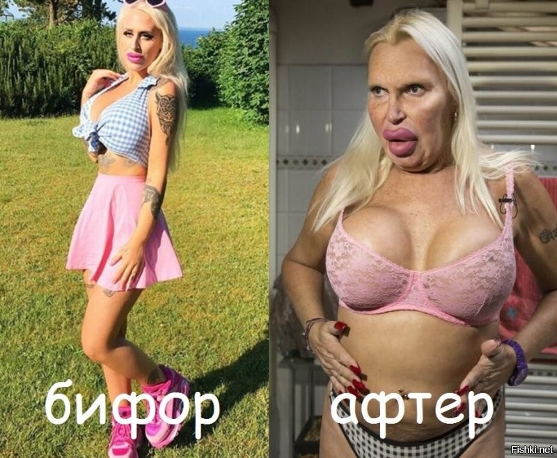 Украинка с «самыми большими в мире щеками» показала, как выглядела раньше