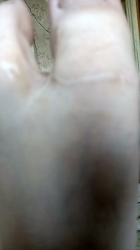 Несколько лет назад перепилил себе большой палец на ноге болгаркой с диском по дереву, слава богу не совсем отрезал. Зато узнал что ходить без него очень неудобно, оказывается при ходьбе он принимает на себя весьма приличную нагрузку.