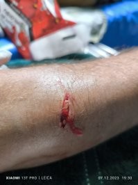 Проблемы этих обезьянок:
1. Отмудухать можно, но прибежит стая на выручку сородича, и там будут не только царапины, но глубокие укусы, которые куда опаснее, и делают так молниеносно.
2. Они почти все больные какой-нибудь хренью, полгода, как минимум, будете принимать вакцины от бешенства и пить таблетки от герпеса.
P. S. Друг рассказывал.