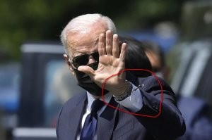 У него оборвался трос управления кистью руки? Разваливается дед, ремонтировать уже бесполезно., износ - 100%.