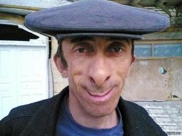Зачем филиппинцы цепляют детям прищепки на нос