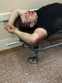 Попытаюсь чуть уравновесить хорошей новостью)

В Воронеже армянину на стрелке прострелили коленную чашечку.

Как пишет подписчик, ара наехал на местного жителя из-за парковки, тот его несколько помял. Ара такого позора снести не смог и позвал турборусича на стрелку «адын на адын». Наш мужик молодцом оказался, не поверил аре и прихватил с собой пару друзей - чай не на турнир рыцарский позвали. Придя на стрелку ,мужик увидел там армянина с группой поддержки. Одного выстрела в воздух оказалось достаточно, чтобы спугнуть стаю армяшек, бросивших своего вожака на «поле боя». Второй выстрел пришёлся уже по самому аре - прямо в коленную чашечку, превратив её в костяной фарш. Напоследок местные его ещё и отх*ячили для профилактики, сейчас он лежит в больничке, лечится и рефлексирует, пытаясь понять, что же он сделал не так.