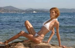 Чо, прям вот так? Ужас какой... Не примут ее в Парижу больше