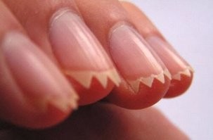 45 шокирующих и тревожных фотографий, которые хочется развидеть