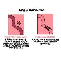 Слева аутсульт.