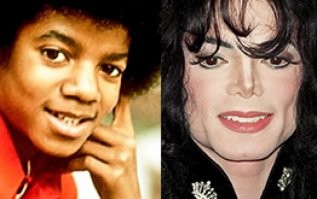 Вот кто реально ненавидел свой нос и не только...