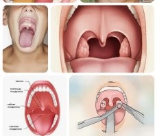 Отоларинголог проверяет на припухлость.