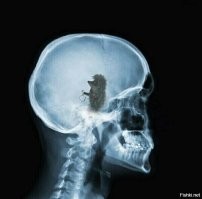 ёжик головного мозга