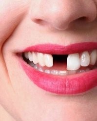В аэропорту на Камчатке дебоширка покусала полицейских