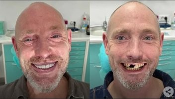 20 сравнительных изображений, которые предлагают другую точку зрения