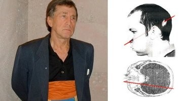 Как бы это не звучало, но да. Гуманней, зная дозу, его было сразу усыпить. Но, раз уж представился такой уникальный случай - будут пробовать все экспериментальные техники и лекарства и смотреть что да как и с какой эффективностью действует. Авост и выкарабкается,  а если нет - богатейший материал поможет другим с менее сильной дозой облучения. Звучит не очень, и его разумеется не пытали, а пытались снять болевую нагрузку (а любые обезболивающие - смазывают картину анализов и так или иначе влияют на другие препараты.. поэтому те же японцы в 731 - в живую людей препарировали банально привязав к столу - и получали довольно чистые экспериментальные данные), но и просто так  - дать ему помереть, никто не  хотел. Надо лечить, надо пересаживать кожу, надо переливать кровь, надо давать препараты, надо менять костный мозг.. Надо смотреть, как развивается клиническая картина. Иногда, помогает. Например, из когтей смерти, советские врачи вытащили Анатолия Петровича Бугорского, который голову в ускоритель засунул, не зная что тот работает.