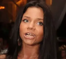 Ну всё логично.
Хлебало она себе уже поправила, теперь очередь титек
Кто не в курсе, то до операций эта жаба выглядела вот так