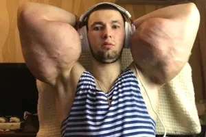 Только этот сам дурак, а у неё болезнь.