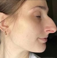 Сходство, действительно, есть.