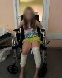 Собака напала на&nbsp;пенсионерку и школьницу