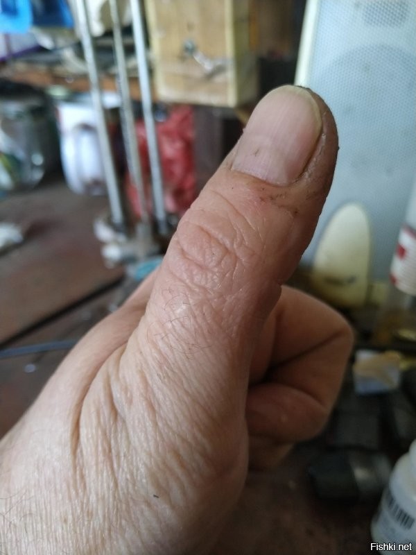 Никогда не делайте надрез на сторожке таким образом, как показывает этот юноша. Мне примерно столько же лет было, когда заполучил вот этот шрам, надрезая сторожок. До кости.