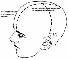 <<темечко сзади>>
извините, но темечко = с верху ..
теменная кость - сзади