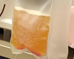 Если убрать из крови мужика эритроциды останется пиво?