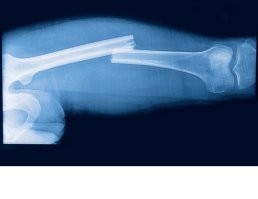 В Уфе мужик сломал член во время интима