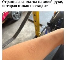 15 фотографий людей с нетипичными особенностями тела