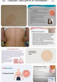 15 фотографий людей с нетипичными особенностями тела