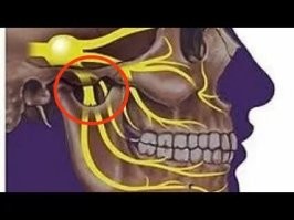 Когда у меня случился дичайший гайморит, а точнее фронтит, воспаление затронуло троичный нерв с одной стороны. И дико болело всё с этой стороны, и глаз, и зубы, и ухо. И после первого прокола, промывки, и закачки антибиотика, боль спала, но не сильно. А вот помазать звездочкой, именно в районе соединения челюстей, помогало часа на три-четыре. 
На твоем рисунке обрезана нижняя челюсть, а именно между ней и черепом есть отверсие, где ближе всего к нерву, вот там и надо мазать.