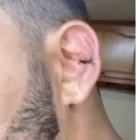 Теперь может серьгу вставить.