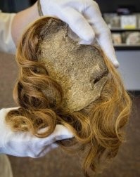 "во время попытки приседа с огромным весом из глаз и скальпа полилась кровь. "

автор - откровенный дебилоид.
скальп - это то, что с головы уже срезали. кожа с волосами, отделённая от черепа.