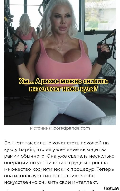 20 обычных людей, прославившихся благодаря пластике