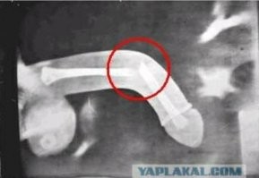 Бурный секс обойдётся жителю Подмосковья в 1,2 миллиона рублей