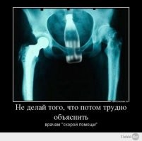 Пьяный вахтовик засунул в себя четыре батарейки