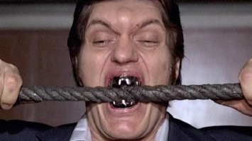 Женщина отдала все деньги на новые зубы и "постарела на 20 лет" за один день